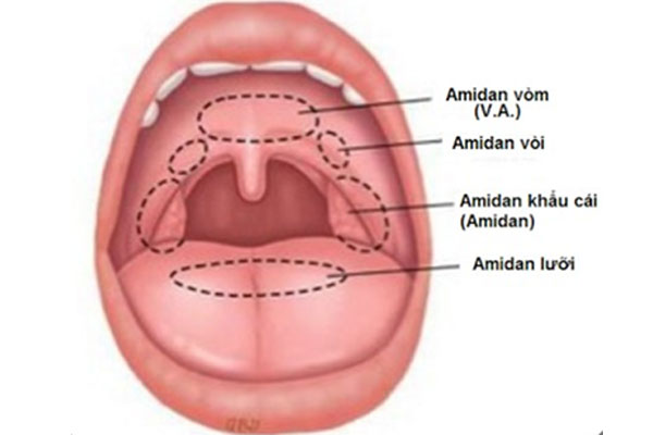 Thế nào là viêm Amidan? 1 Thế nào là viêm Amidan? 1