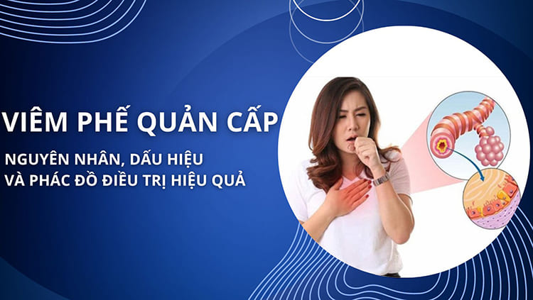 Viêm phế quản cấp là gì? Nguyên nhân, dấu hiệu và phác đồ điều trị hiệu quả nhất