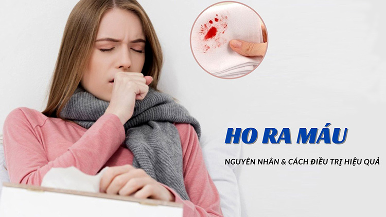 Ho ra máu là bệnh gì? Cách chẩn đoán và điều trị bệnh an toàn tránh tái phát