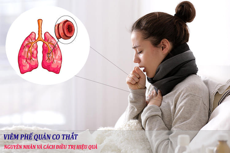 Viêm phế quản co thắt là gì? Nguyên nhân, cách điều trị và phòng ngừa hiệu quả