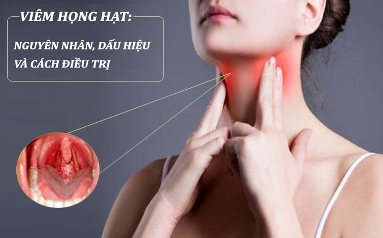 Viêm họng hạt là gì? Nguyên nhân, mức độ nguy hiểm và cách điều trị